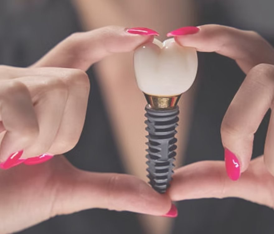 Implante dentário com coroa sendo segurado em formato de coração